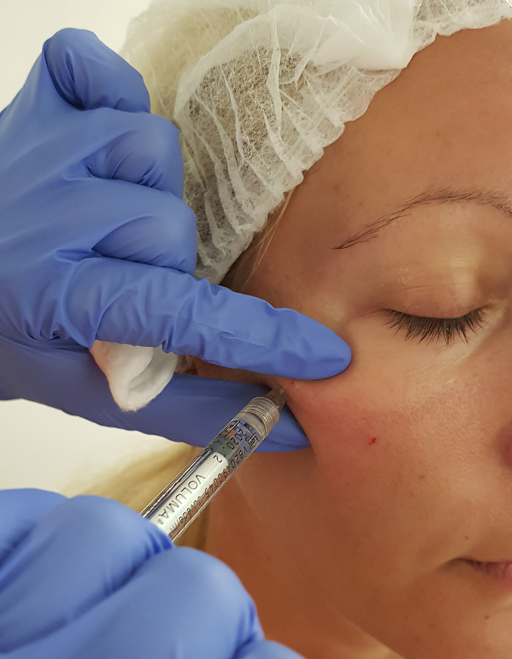 Dermal-fillers-–-Introductory
